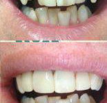 Your Dentist Gunnedah - Gold Coast Dentists