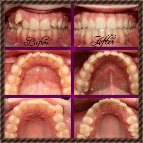 Coral Coast Dental - Gold Coast Dentists 12