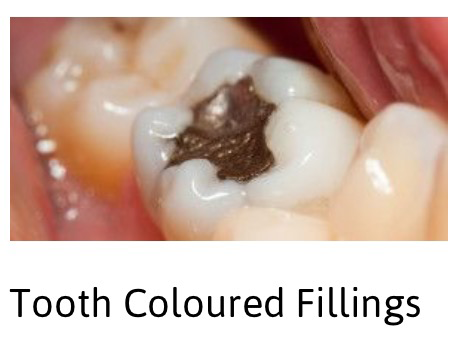 A2Z Dental - Gold Coast Dentists 3