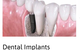 A2Z Dental - thumb 4