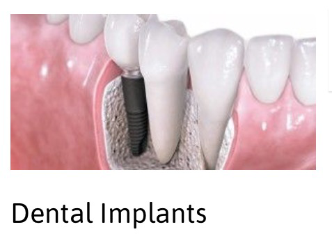 A2Z Dental - Gold Coast Dentists 4