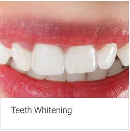 Aura Dental Centre - Gold Coast Dentists 5