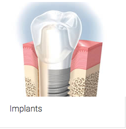 Aura Dental Centre - Gold Coast Dentists 6